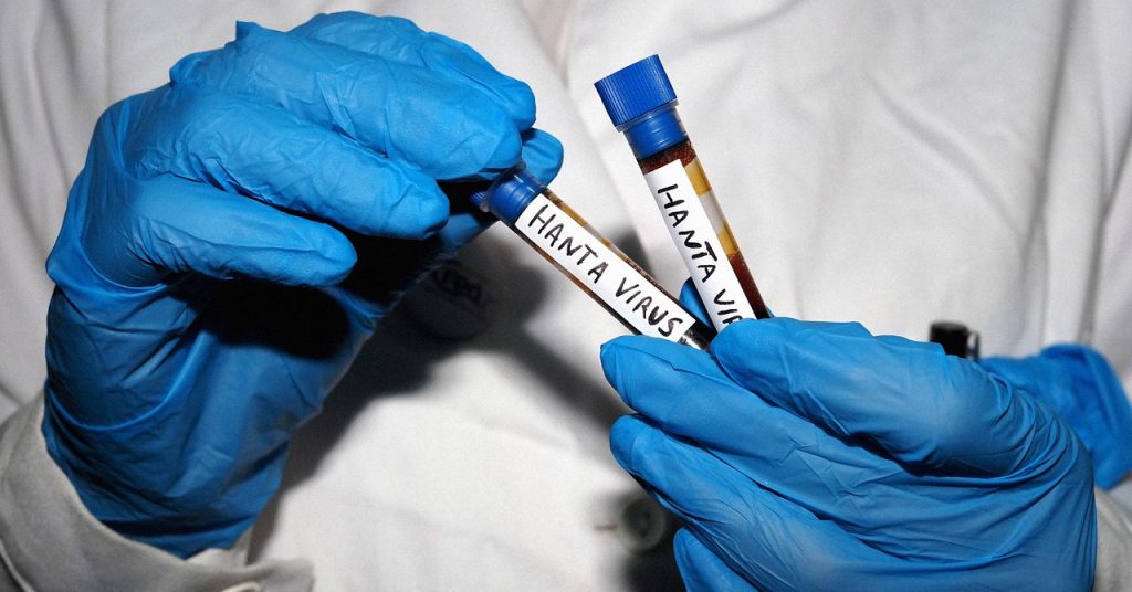 All Your Hantavirus Questions, Answered by an Infectious Disease Expert All Your Hantavirus Questions, Answered by an Infectious Disease Expert